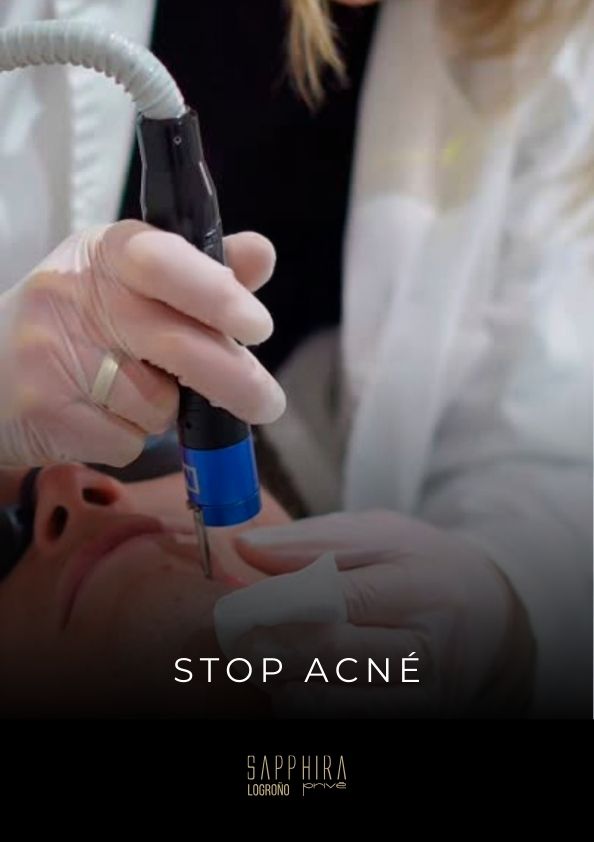 Stop acné